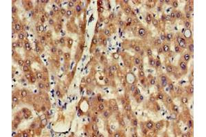 Immunohistochemistry of paraffin-embedded human liver tissue using ABIN7159597 at dilution of 1:100 (MSRB1 antibody  (AA 1-116))