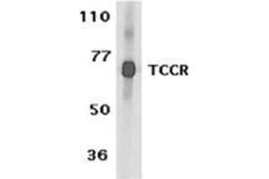 Western blot analysis of TCCR expression in human spleen tissue lysates with this product at 1 μg /ml.