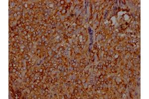 IHC image of ABIN7127599 diluted at 1:100 and staining in paraffin-embedded human adrenal gland tissue performed on a Leica BondTM system.