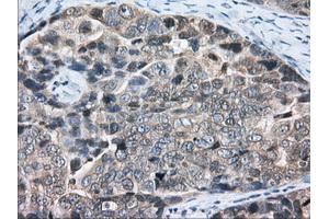 Immunohistochemical staining of paraffin-embedded Human liver tissue using anti-PDE4A mouse monoclonal antibody.