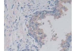 Detection of LACTb in Human Prostate Tissue using Polyclonal Antibody to Lactamase Beta (LACTb) (LACTB antibody  (AA 313-547))