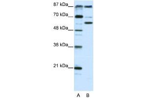 WB Suggested Anti-PCAF Antibody Titration:  2. (KAT2B antibody  (N-Term))
