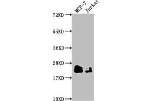 Western Blot Positive WB detected in: MCF-7 whole cell lysate, Jurkat whole cell lysate All lanes: MGMT antibody at 1:1500 Secondary Goat polyclonal to rabbit IgG at 1/50000 dilution Predicted band size: 22 kDa Observed band size: 22 kDa (Recombinant MGMT antibody)