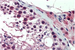ABIN571037 (10µg/ml) staining of paraffin embedded Human Testis. (PREX1 antibody  (Internal Region))