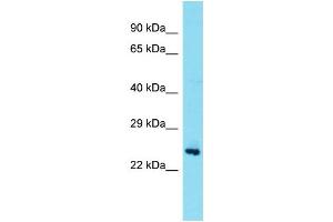 Host: Rabbit Target Name: TEX36 Sample Type: Fetal Brain lysates Antibody Dilution: 1. (TEX36 antibody  (Middle Region))