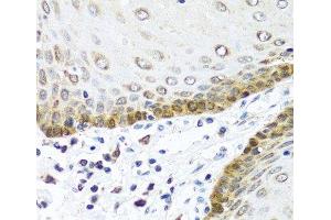 Immunohistochemistry (Paraffin-embedded Sections) (IHC (p)) image for anti-Bone Morphogenetic Protein 5 (BMP5) antibody (ABIN7264429)