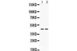 Western blot analysis of Cathepsin K expression in HELA whole cell lysates (lane 1) and 22RV1 whole cell lysates (lane 2).