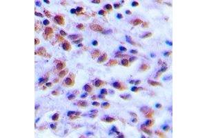 Immunohistochemistry (IHC) image for anti-S100 Calcium Binding Protein A12 (S100A12) antibody (ABIN7308302) (S100A12 antibody)