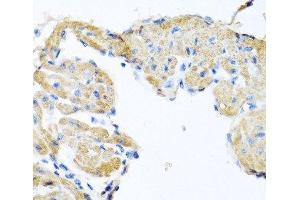 Immunohistochemistry (Paraffin-embedded Sections) (IHC (p)) image for anti-Glycosylphosphatidylinositol Specific phospholipase D1 (GPLD1) antibody (ABIN7262487)