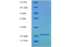 SDS-PAGE (SDS) image for Immune Receptor Expressed On Myeloid Cells 1 (IREM1) (AA 20-156) protein (His tag) (ABIN5711523)