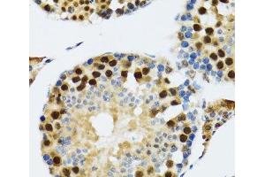 Immunohistochemistry of paraffin-embedded Rat testis using TXNL1 Polyclonal Antibody at dilution of 1:100 (40x lens). (TXNL1 antibody)