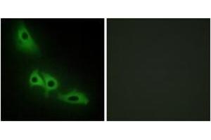 Immunofluorescence analysis of HeLa cells, using GK Antibody. (Glycerol Kinase antibody  (AA 461-510))