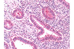 Immunohistochemistry (IHC) image for anti-G Protein-Coupled Receptor, Family C, Group 5, Member A (GPRC5A) (Cytoplasmic Domain) antibody (ABIN1048906)