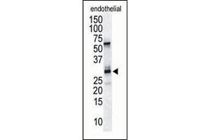 Antibody is used in Western blot to detect RCAN1/DSCR1 in endothelial tissue lysate. (RCAN1 antibody  (C-Term))