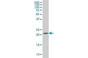 RAB2B antibody  (AA 127-216)