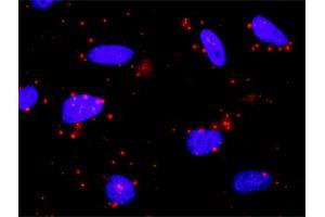 Proximity Ligation Analysis of protein-protein interactions between CAMK2A and SMAD2. (CAMK2A antibody  (AA 1-478))