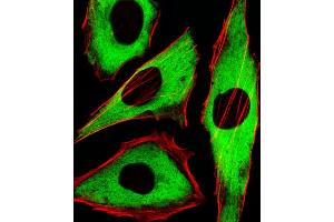 Fluorescent image of Hela cells stained with XAF1 GDH Antibody (ABIN1539789 and ABIN2838005).
