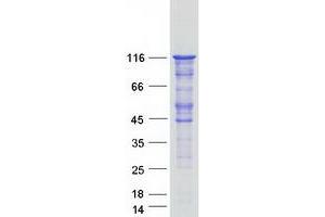 Western Blotting (WB) image for Lipase, Hormone-Sensitive (LIPE) protein (Myc-DYKDDDDK Tag) (ABIN2724771)