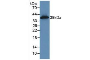 Detection of Recombinant KRT16, Human using Monoclonal Antibody to Cytokeratin 16 (CK16) (KRT16 antibody  (AA 117-419))