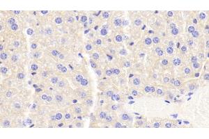 Detection of APOC3 in Mouse Liver Tissue using Monoclonal Antibody to Apolipoprotein C3 (APOC3) (APOC3 antibody  (AA 21-99))