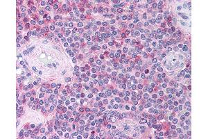 CCL18 antibody  (C-Term)