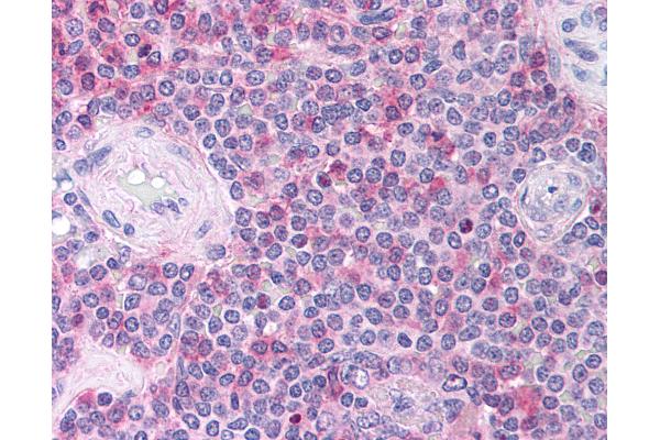 CCL18 antibody  (C-Term)