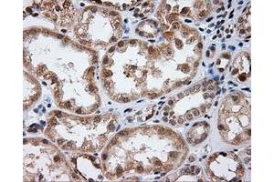 Immunohistochemical staining of paraffin-embedded Kidney tissue using anti-LIPG mouse monoclonal antibody. (LIPG antibody)