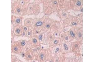 IHC-P analysis of liver tissue, with DAB staining. (APMAP antibody  (AA 62-289))