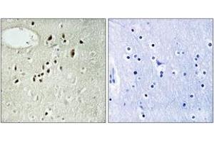 Immunohistochemistry analysis of paraffin-embedded human brain tissue, using EMX2 Antibody. (EMX2 antibody  (AA 91-140))