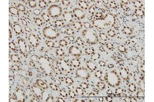 Image no. 5 for anti-Regulation of Nuclear Pre-mRNA Domain Containing 1A (RPRD1A) (AA 76-171) antibody (ABIN466219) (RPRD1A antibody  (AA 76-171))