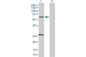 Western Blot analysis of SOCS4 expression in transfected 293T cell line by SOCS4 MaxPab polyclonal antibody. (SOCS4 antibody  (AA 1-440))