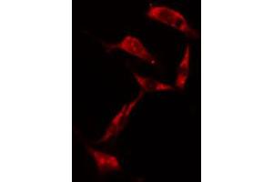 ABIN6274203 staining NIH-3T3 cells by IF/ICC. (RPS6KB1 antibody  (C-Term))