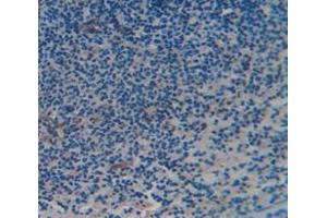 IHC-P analysis of Kidney tissue, with DAB staining. (CD6 antibody  (AA 477-644))