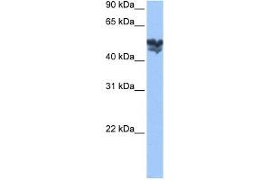 WASF3 antibody used at 1 ug/ml to detect target protein. (WASF3 antibody  (Middle Region))