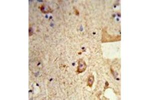 Formalin-fixed and paraffin-embedded human brain tissue reacted with Destrin Antibody , which was peroxidase-conjugated to the secondary antibody, followed by DAB staining. (Destrin antibody  (Middle Region))