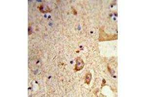 Formalin-fixed and paraffin-embedded human brain tissue reacted with Destrin Antibody , which was peroxidase-conjugated to the secondary antibody, followed by DAB staining. (Destrin antibody  (Middle Region))