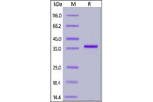 SARS-CoV-2 Papain-like Protease, His Tag on SDS-PAGE under reducing (R) condition.