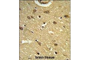 Formalin-fixed and paraffin-embedded human brain tissue reacted with UB Antibody (N-term), which was peroxidase-conjugated to the secondary antibody, followed by DAB staining. (UBAP1 antibody  (N-Term))