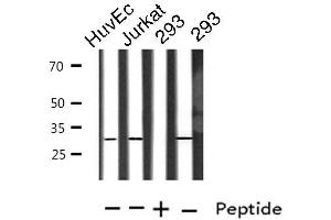 Western blot analysis of extracts from HuvEc/Jurkat/293 cells, using TOLLIP antibody. (TOLLIP antibody  (Internal Region))