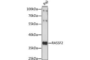 Western blot analysis of extracts of Raji cells, using R antibody (ABIN7269859) at 1:1000 dilution. (RASSF2 antibody  (AA 70-160))
