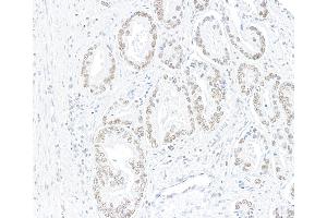 Immunohistochemistry (IHC) image for anti-AT Rich Interactive Domain 1A (SWI-Like) (ARID1A) (AA 750-800) antibody (ABIN7795678)