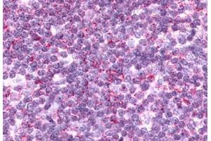 Anti-CCR9 antibody  ABIN1048405 IHC staining of human thymus, lymphocytes.