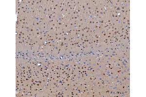 IHC analysis of CEP250 using anti-CEP250 antibody (ABIN7602053). (CEP250 antibody  (AA 563-853))