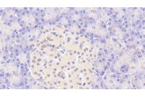 Detection of CASP9 in Human Pancreas Tissue using Polyclonal Antibody to Caspase 9 (CASP9) (Caspase 9 antibody  (AA 331-416))