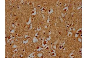 IHC image of ABIN7171265 diluted at 1:300 and staining in paraffin-embedded human brain tissue performed on a Leica BondTM system. (STXBP5 antibody  (AA 515-610))
