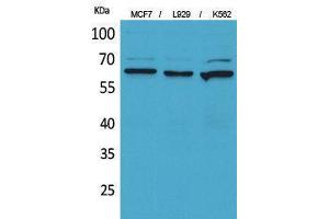 Western Blotting (WB) image for anti-5'-Nucleotidase, Ecto (CD73) (NT5E) (Internal Region) antibody (ABIN3178285) (CD73 antibody  (Internal Region))