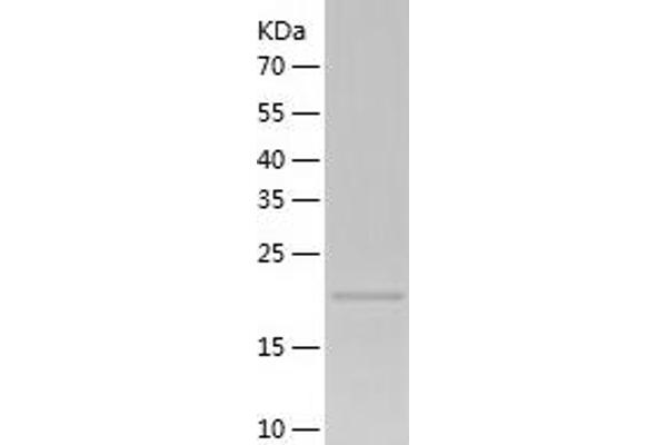 Translin Protein (TSN) (AA 1-228) (His tag)