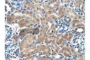 SDCBP antibody was used for immunohistochemistry at a concentration of 4-8 ug/ml to stain Epithelial cells of renal tubule (arrows) in Human Kidney. (SDCBP antibody)