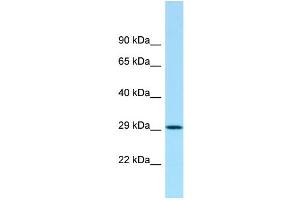 Western Blotting (WB) image for anti-Aminoacylase 3 (ACY3) (C-Term) antibody (ABIN2789192) (Aminoacylase 3 antibody  (C-Term))