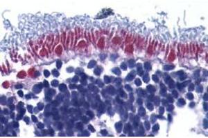 Immunohistochemistry of AIF in human retina with AIF antibody at 10 μg/ml. (AIF antibody  (Intermediate Domain))